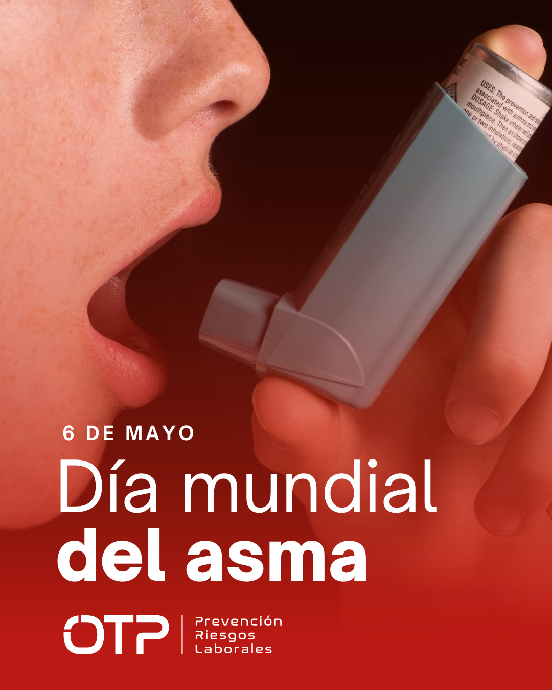Asma laboral: una prioridad en la vigilancia de la salud en el trabajo